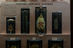 Case 64 Structure 5 Brains and Central Nervous System Case 64 Structure 5 Brains and Central Nervous System